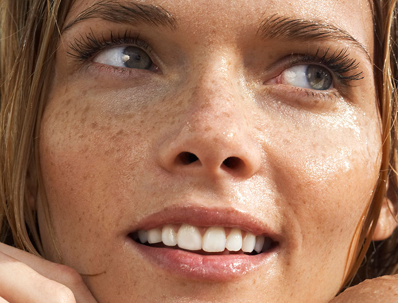 A Guide To Lasers What's Right For Your Skin? Skin NV Tampa Med Spa
