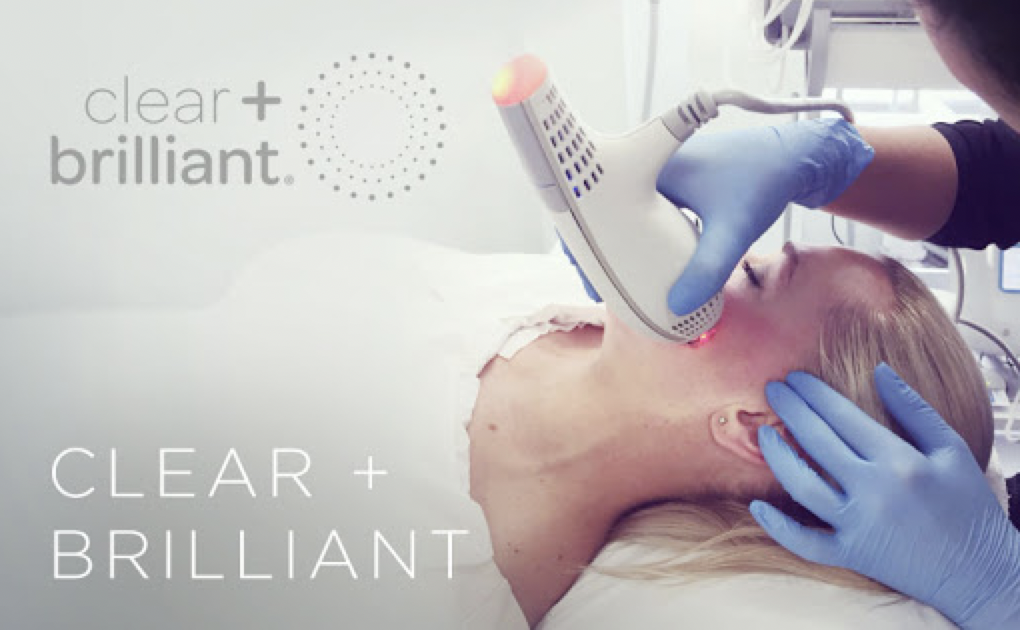 The Ultimate Guide to Clear + Brilliant Laser Exfoliation (New Laser) Skin NV Tampa Med Spa