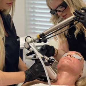 Tetra CoolPeel and Virtue RF Microneedling Tampa