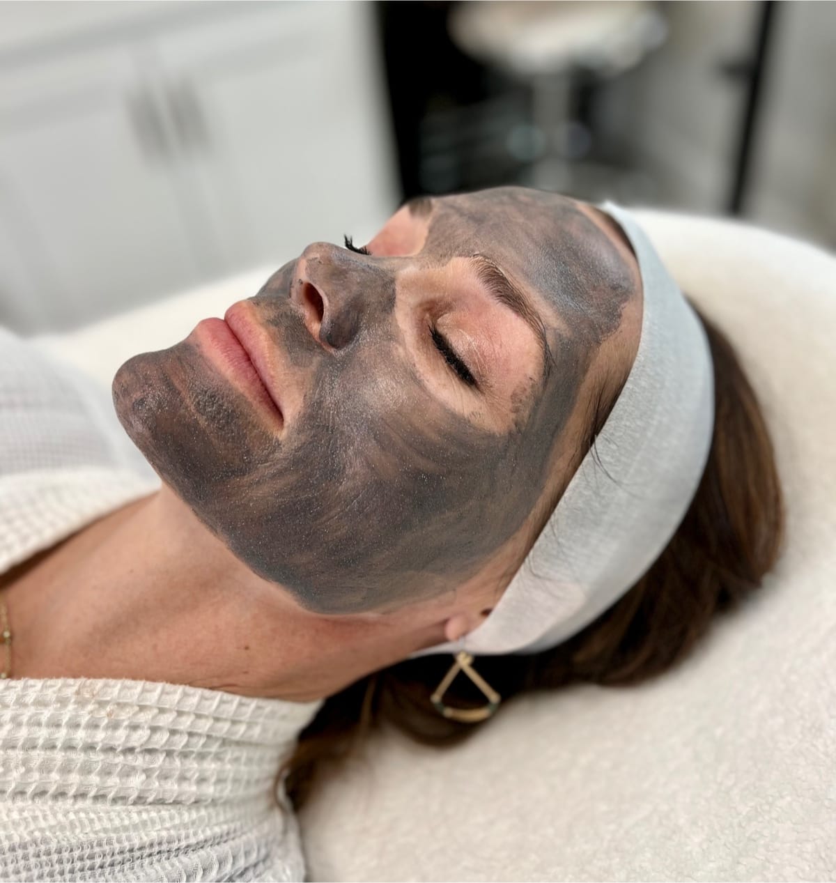 Hollywood Carbon Laser Peel at SkinNV