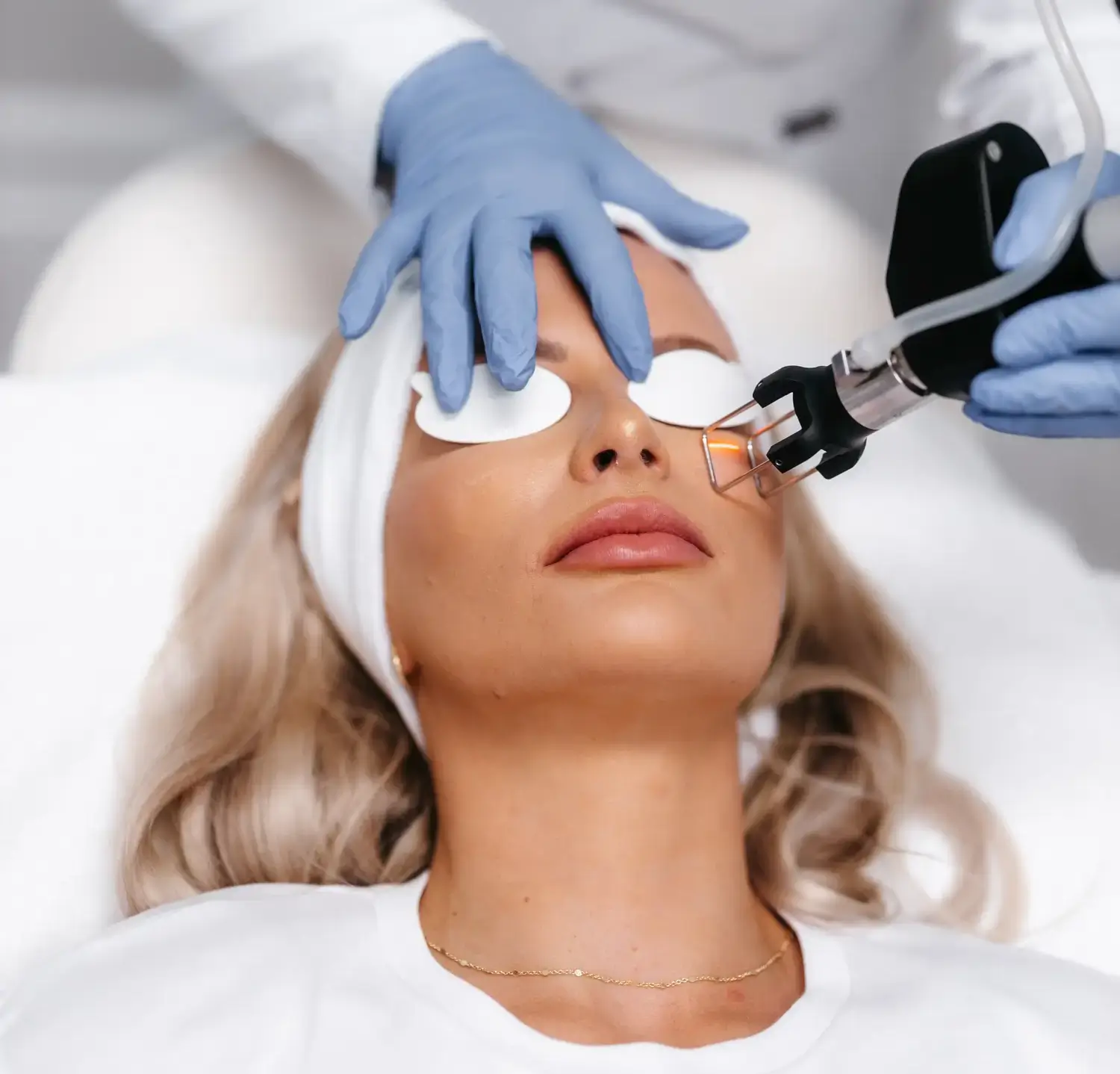 CO2 Laser Resurfacing Tampa