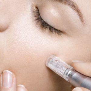 Tampa Microneedling at Skin NV Med Spa Tampa FL