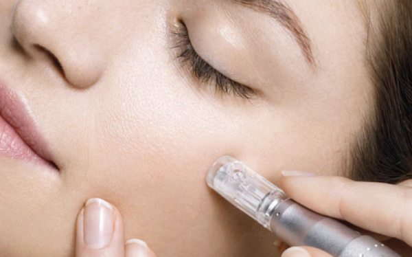 Tampa Microneedling at Skin NV Med Spa Tampa FL