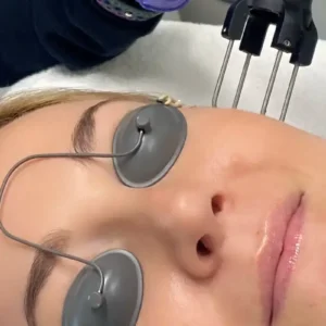 CoolPeel CO2 Laser Skin Resurfacing