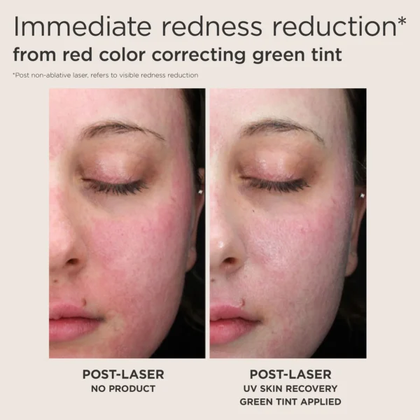 EltaMD UV Skin Recovery Red Color Correcting Green Tint Broad Spectrum SPF 50 - Image 3
