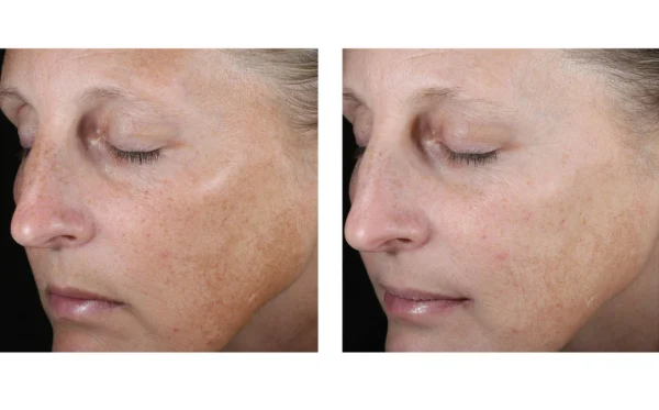 SkinBetter AlphaRet Overnight Cream - Image 2