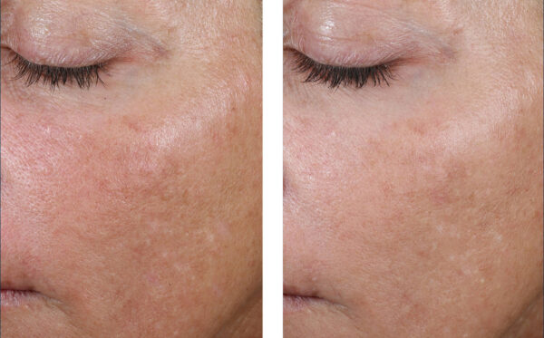 SkinBetter AlphaRet Overnight Cream - Image 4