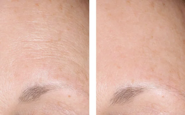 SkinBetter AlphaRet Overnight Cream - Image 3