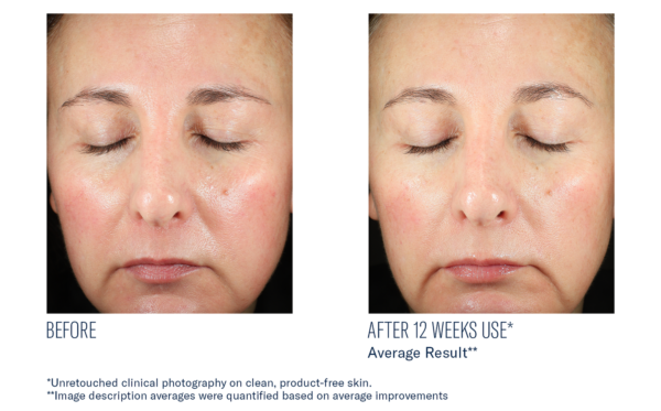 SkinBetter BioRewind Skin Health Dietary Supplement - Image 7