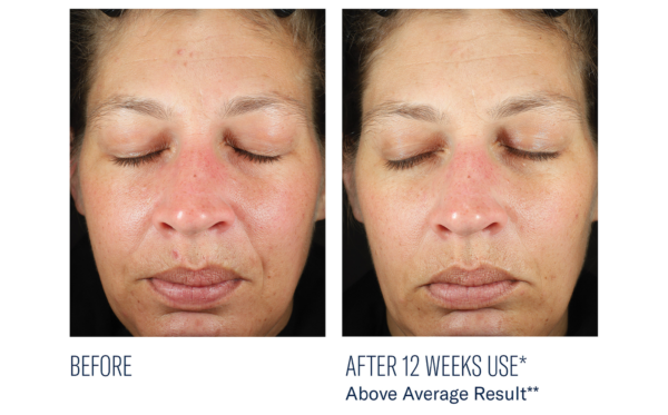 SkinBetter BioRewind Skin Health Dietary Supplement - Image 6
