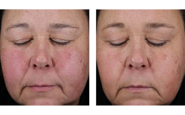 SkinBetter Mystro Active Balance Serum - Image 2