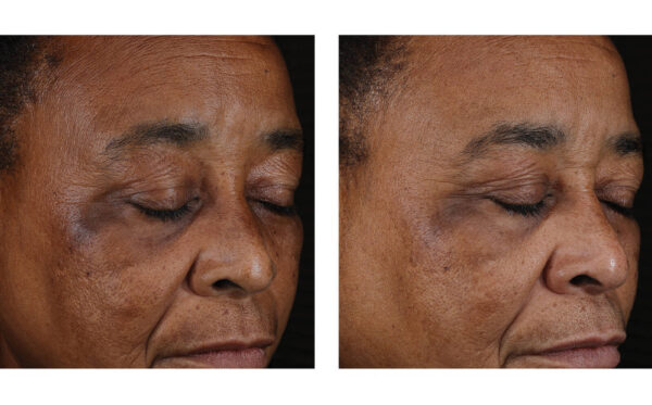 SkinBetter Mystro Active Balance Serum - Image 4
