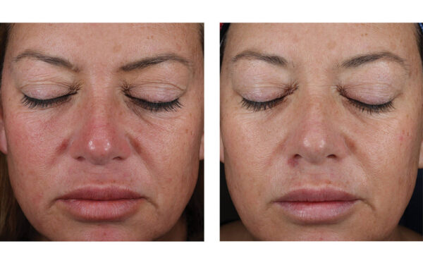 SkinBetter Mystro Active Balance Serum - Image 3