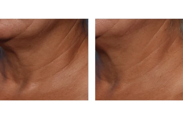 SkinBetter Techno Neck Perfecting Cream - Image 2